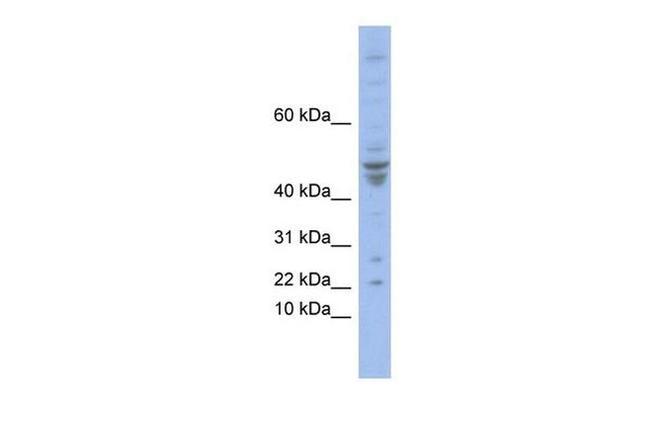 POLE4 Antibody in Western Blot (WB)