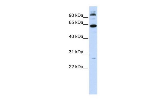 MNT Antibody in Western Blot (WB)
