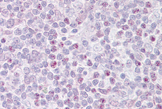 EBF1 Antibody in Immunohistochemistry (IHC)