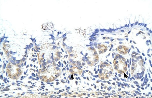 ZNF322A Antibody in Immunohistochemistry (IHC)
