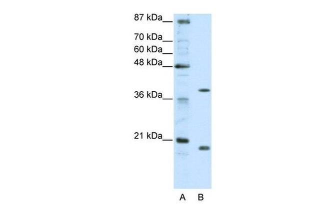 ZNF322A Antibody in Western Blot (WB)