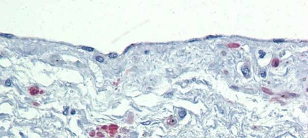 SOX7 Antibody in Immunohistochemistry (IHC)