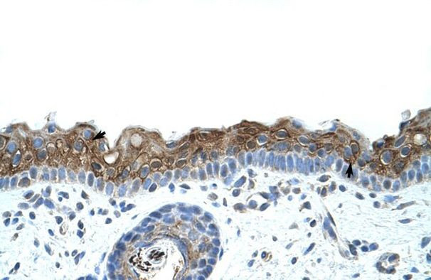 ZNF397 Antibody in Immunohistochemistry (IHC)