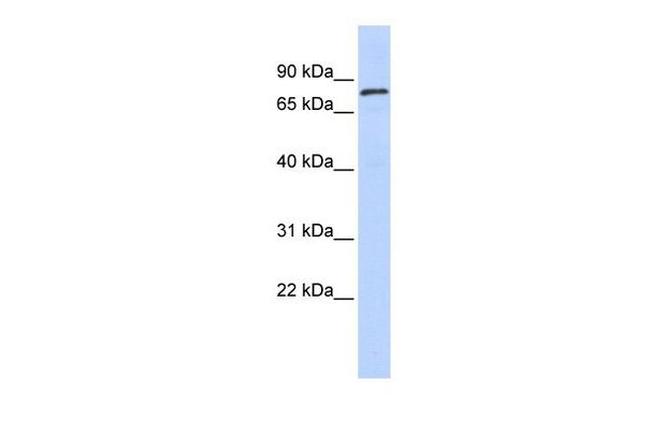 ZNF333 Antibody in Western Blot (WB)