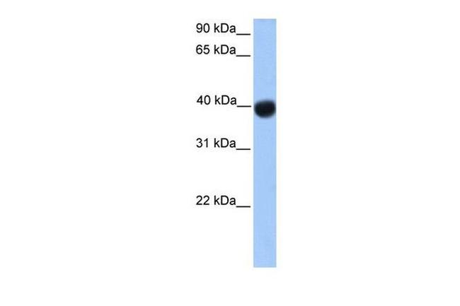 SSBP4 Antibody in Western Blot (WB)