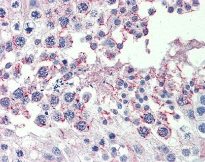 CPXCR1 Antibody in Immunohistochemistry (Paraffin) (IHC (P))