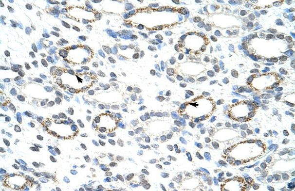 FOXQ1 Antibody in Immunohistochemistry (IHC)