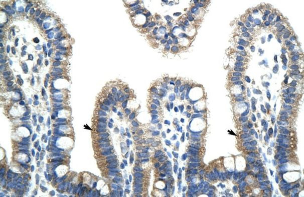 BTBD6 Antibody in Immunohistochemistry (IHC)