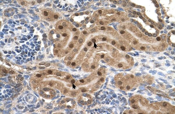 MLX Antibody in Immunohistochemistry (IHC)