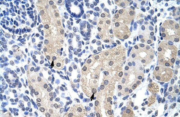 Aprataxin Antibody in Immunohistochemistry (IHC)