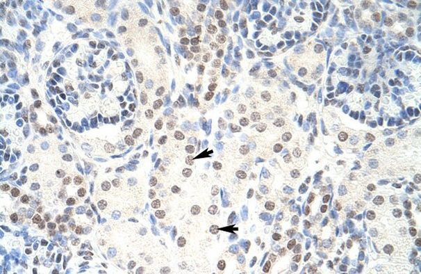 HKR1 Antibody in Immunohistochemistry (IHC)