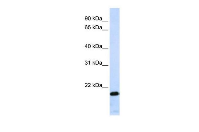 ZNF428 Antibody in Western Blot (WB)