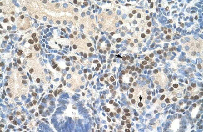 ZNF326 Antibody in Immunohistochemistry (IHC)