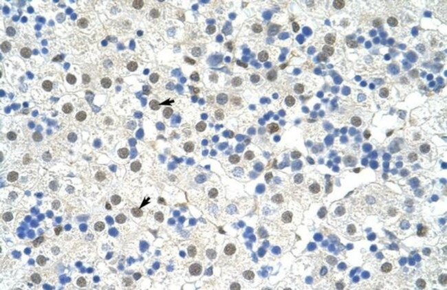 NOBOX Antibody in Immunohistochemistry (IHC)