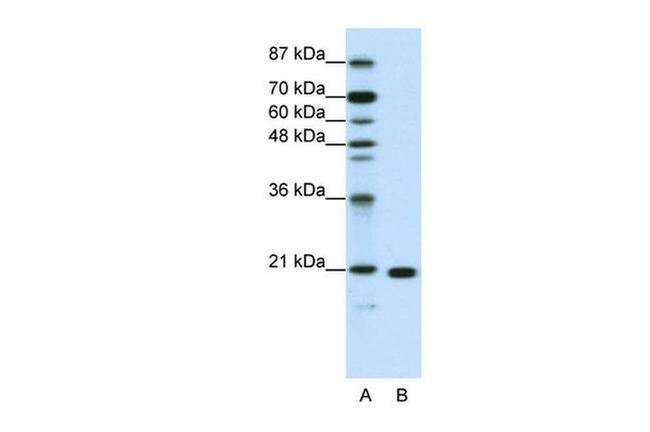 RPL9 Antibody in Western Blot (WB)