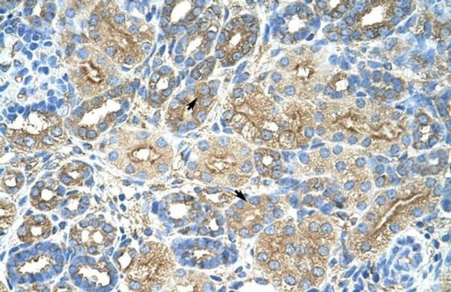 RPL8 Antibody in Immunohistochemistry (Paraffin) (IHC (P))