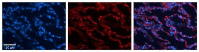 RPL13 Antibody in Immunohistochemistry (Paraffin) (IHC (P))