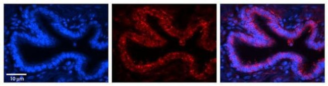 RPLP0 Antibody in Immunohistochemistry (Paraffin) (IHC (P))