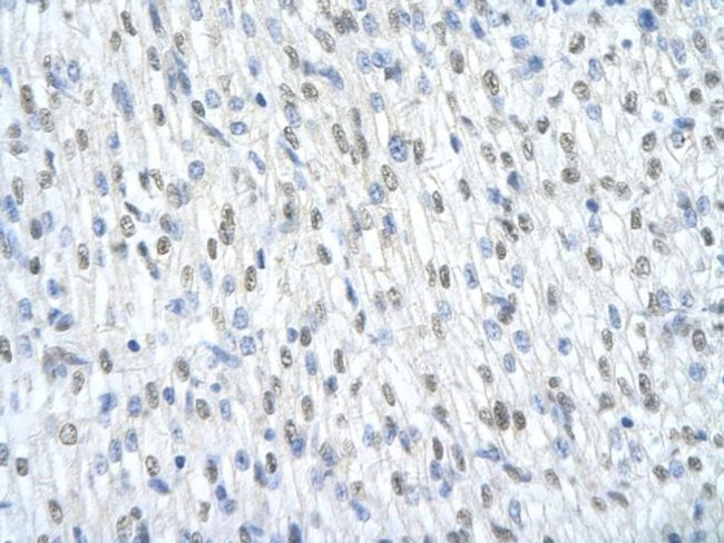 SF3B1 Antibody in Immunohistochemistry (Paraffin) (IHC (P))