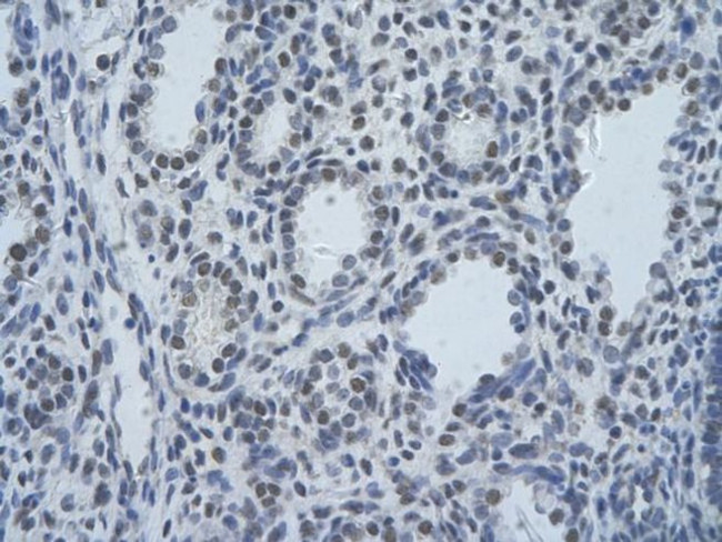 SF3B1 Antibody in Immunohistochemistry (Paraffin) (IHC (P))