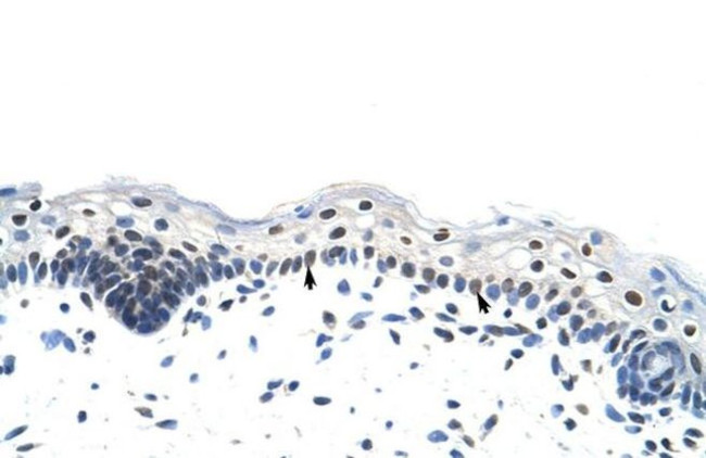 hnRNP A1L2 Antibody in Immunohistochemistry (Paraffin) (IHC (P))