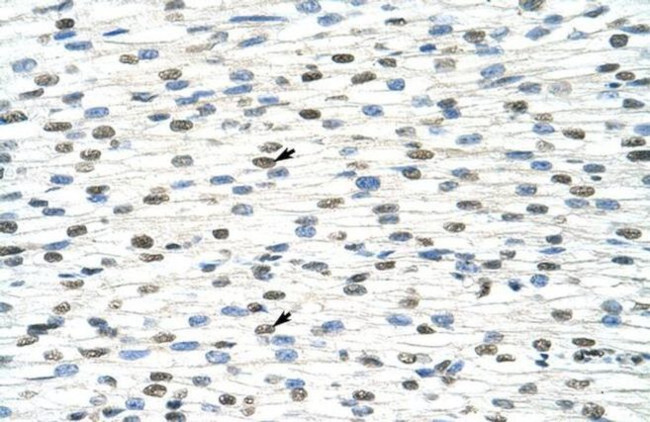 DDX19B Antibody in Immunohistochemistry (Paraffin) (IHC (P))