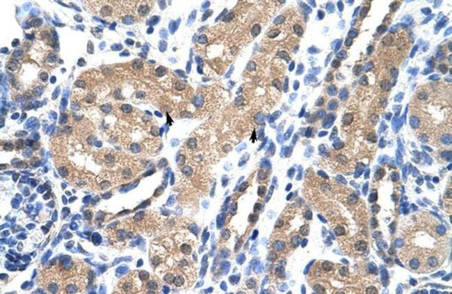 RAE1 Antibody in Immunohistochemistry (Paraffin) (IHC (P))