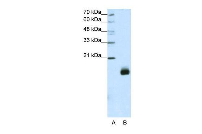 RPS14 Antibody in Western Blot (WB)
