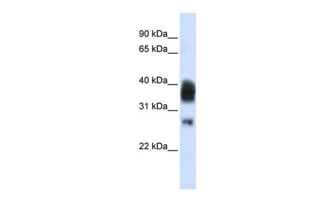 RNaseH1 Antibody in Western Blot (WB)