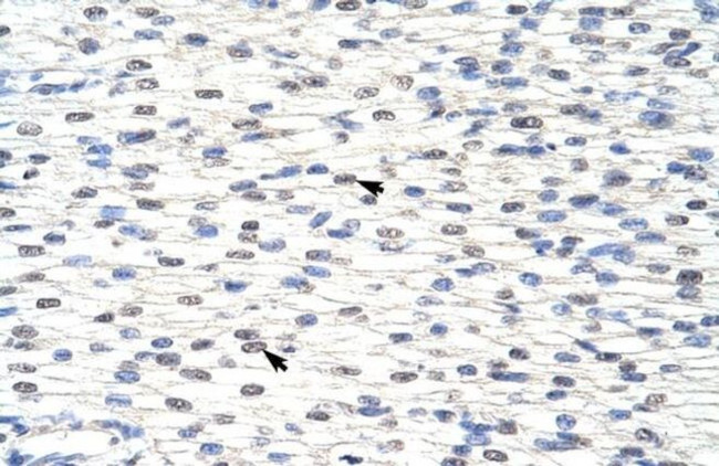 SNRPF Antibody in Immunohistochemistry (Paraffin) (IHC (P))