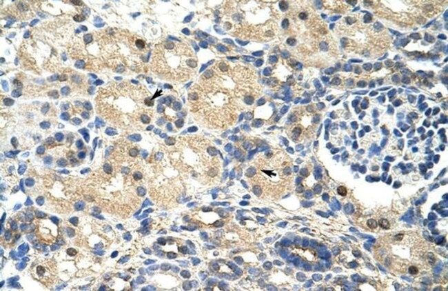 SRP14 Antibody in Immunohistochemistry (Paraffin) (IHC (P))