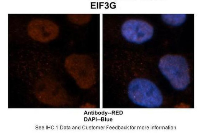 eIF3g Antibody in Immunohistochemistry (IHC)