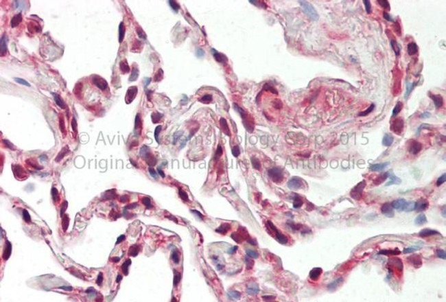 SRSF9 Antibody in Immunohistochemistry (Paraffin) (IHC (P))