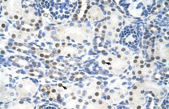 TROVE2 Antibody in Immunohistochemistry (Paraffin) (IHC (P))