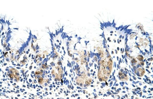 TROVE2 Antibody in Immunohistochemistry (Paraffin) (IHC (P))