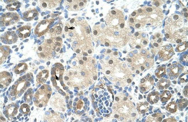 Cyclophilin E Antibody in Immunohistochemistry (Paraffin) (IHC (P))