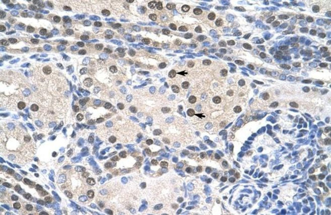 PAIP1 Antibody in Immunohistochemistry (Paraffin) (IHC (P))