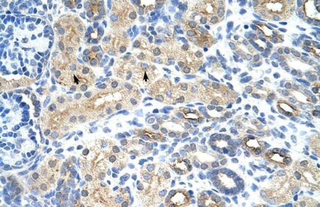 SNRNP35 Antibody in Immunohistochemistry (Paraffin) (IHC (P))
