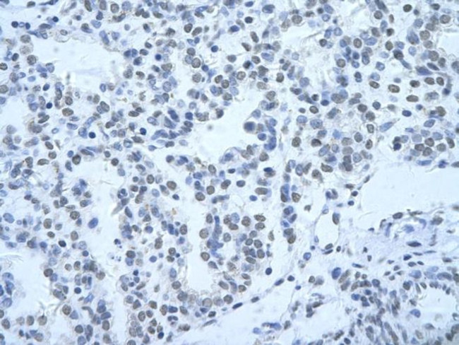 hnRNP H3 Antibody in Immunohistochemistry (Paraffin) (IHC (P))