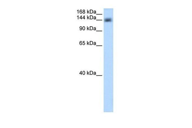 CPSF1 Antibody in Western Blot (WB)