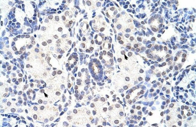 NIP7 Antibody in Immunohistochemistry (Paraffin) (IHC (P))