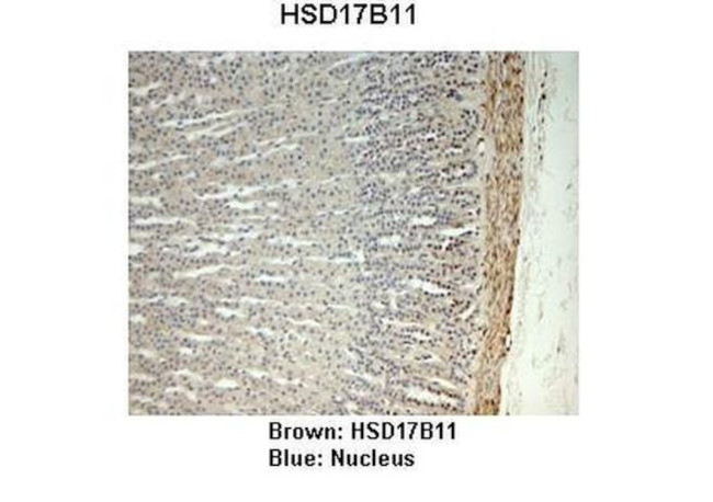 HSD17B11 Antibody in Immunohistochemistry (IHC)
