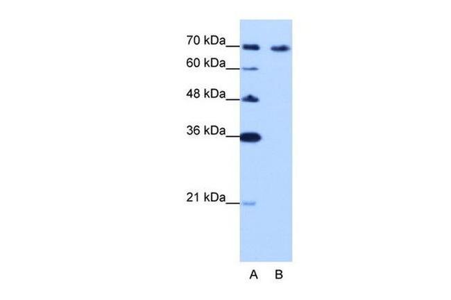 CDKN2AIP Antibody in Western Blot (WB)