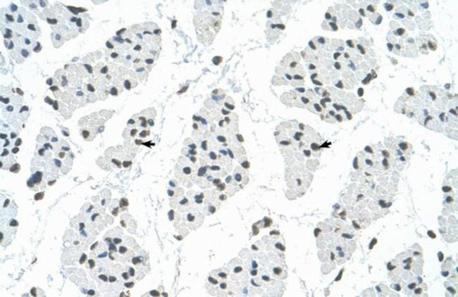 RBM22 Antibody in Immunohistochemistry (Paraffin) (IHC (P))