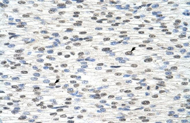 RBM28 Antibody in Immunohistochemistry (Paraffin) (IHC (P))