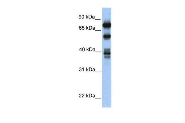 STRBP Antibody in Western Blot (WB)