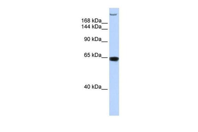TNRC6A Antibody in Western Blot (WB)