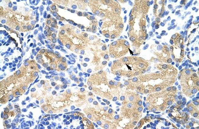 MTHFSD Antibody in Immunohistochemistry (Paraffin) (IHC (P))