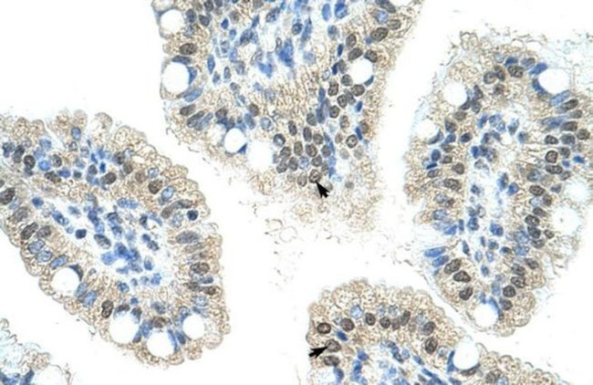 NOL6 Antibody in Immunohistochemistry (Paraffin) (IHC (P))