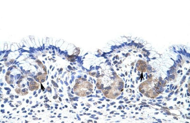 UPF3B Antibody in Immunohistochemistry (Paraffin) (IHC (P))